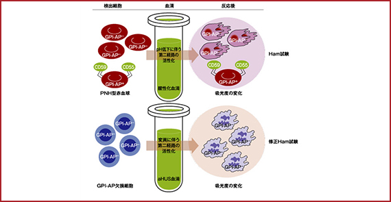 図1　Ham試験および修正Ham試験：PNHとaHUSのin vitroモデル