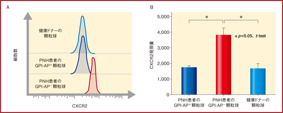 図1　PNH患者のGPI-AP－顆粒球におけるCXCR2の発現亢進