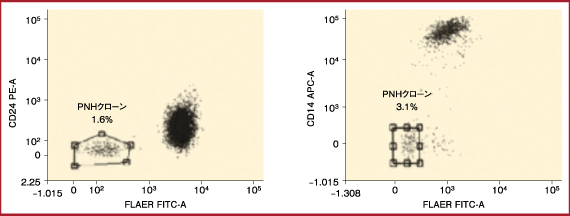 図　FLAERとCD24およびCD14による多形分析に基づくPNHクローンの検出