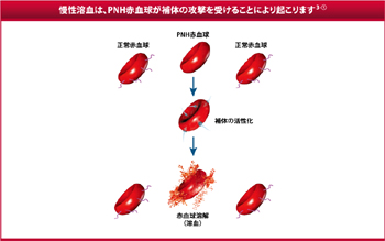 慢性溶血は、PNH赤血球が補体の攻撃を受けることにより起こります3-①。