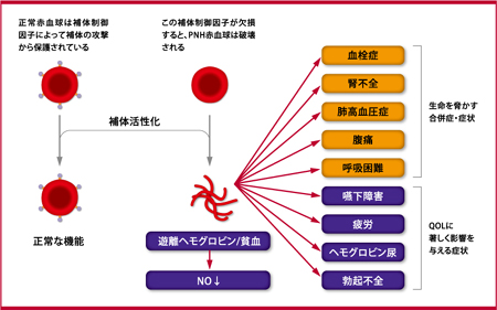 図１：慢性溶血と遊離ヘモグロビンによって引き起こされる合併症・症状5-②-③，5-⑤-⑪