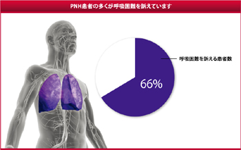 PNH患者の多くが呼吸困難を訴えています。
